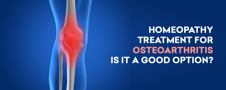 Homeopathy treatment for Osteoarthritis – is it a good option?