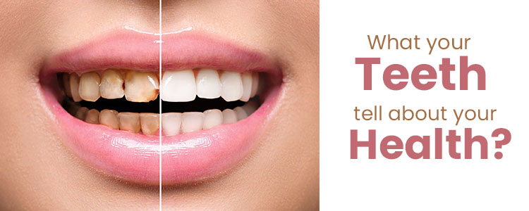 What your teeth tell about your health?
